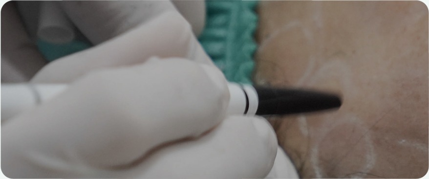 풍부한 시술경험 결과로 나타납니다 image