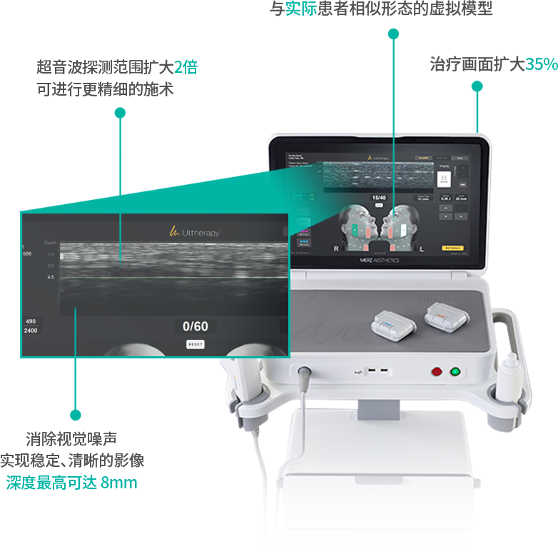 ultheraprime image