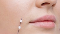 line 1 image