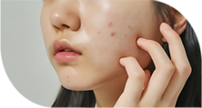毛孔 / 疤痕