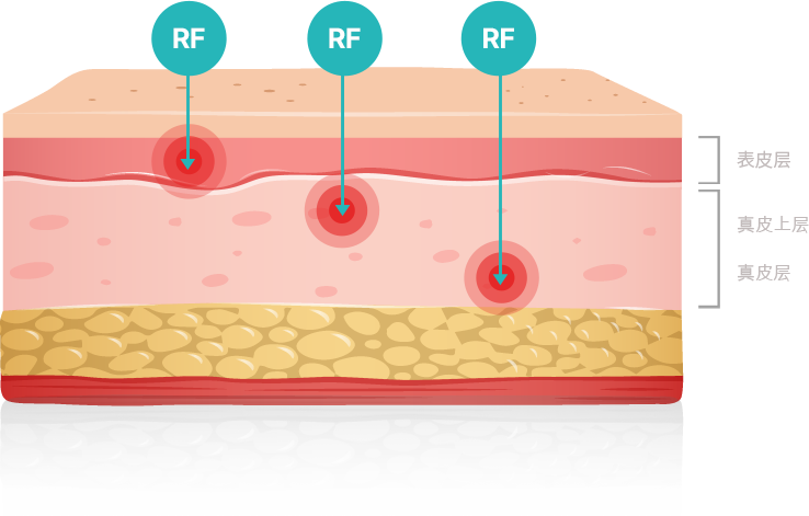 rf image 1