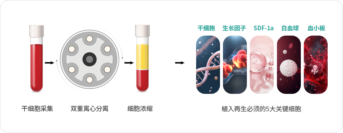 自体血液水光 PROCESS image